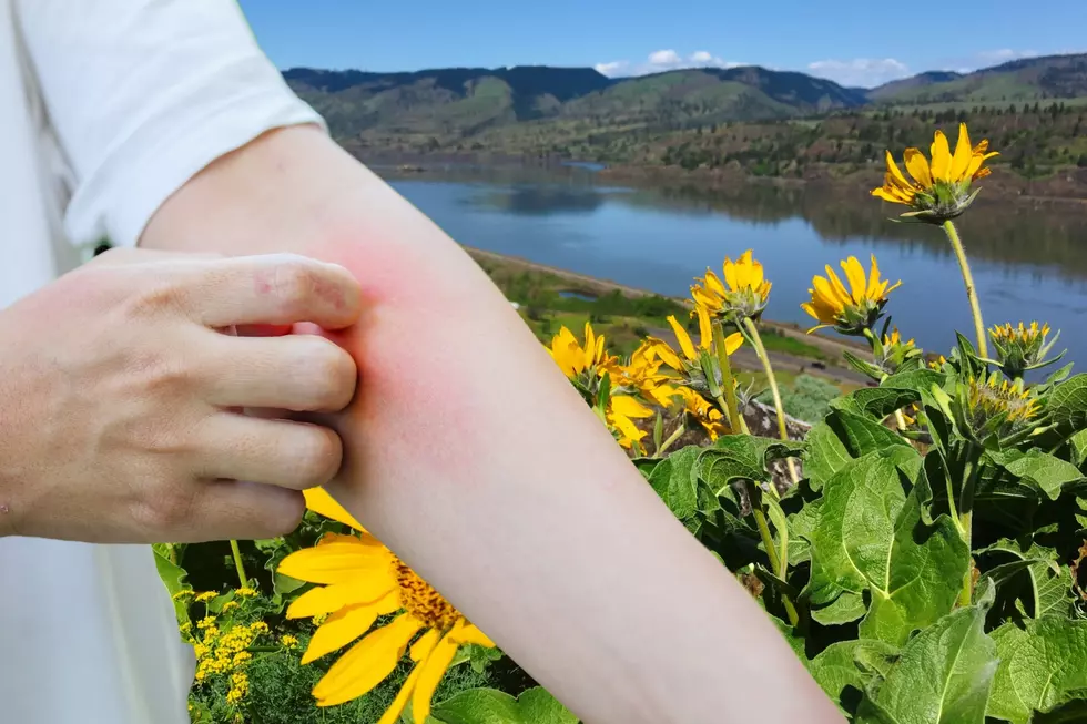 Gross ‘Duck Mites’ In The Columbia Make You Itch But It’s Not What You Think